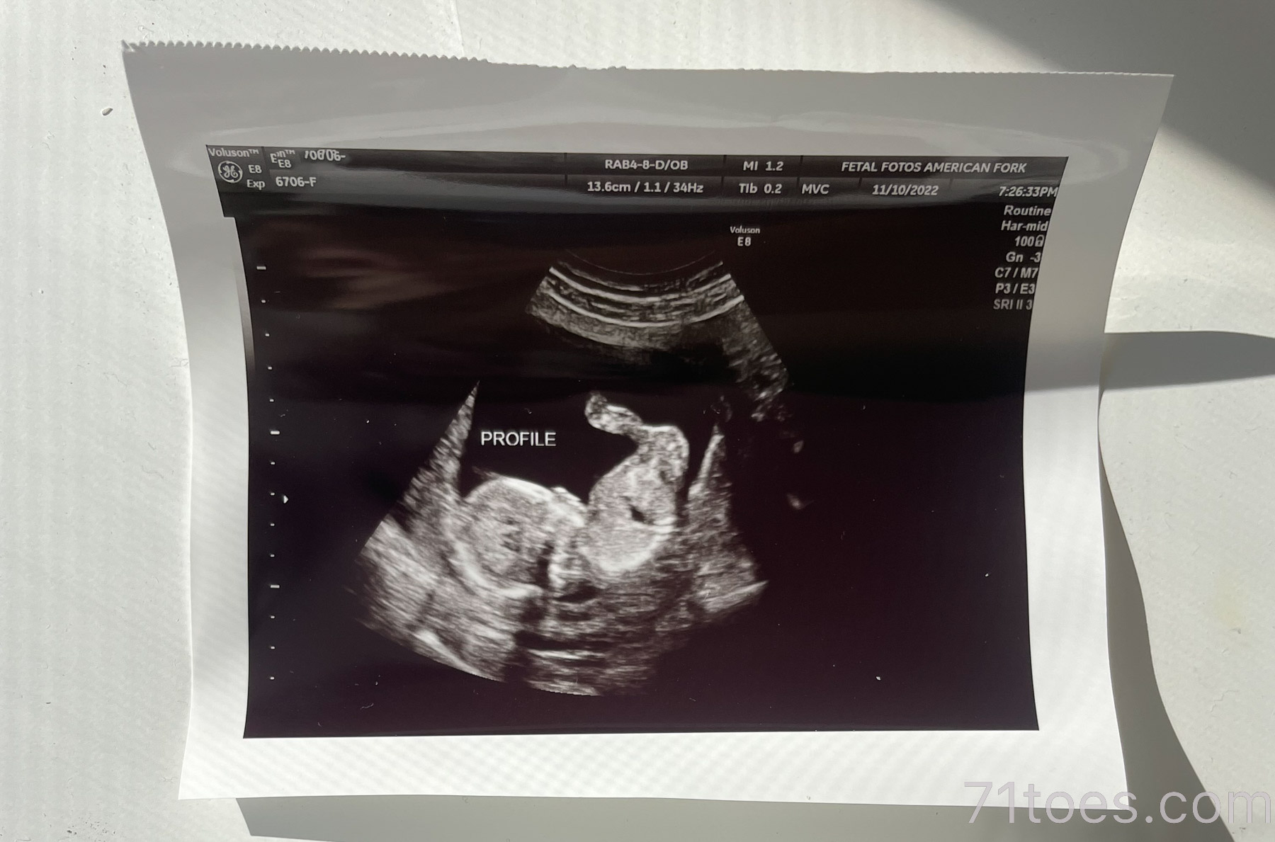 announcing…a little peanut on the way